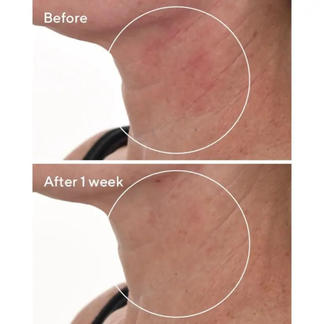 Murad Cellular Hydration Repair Serum