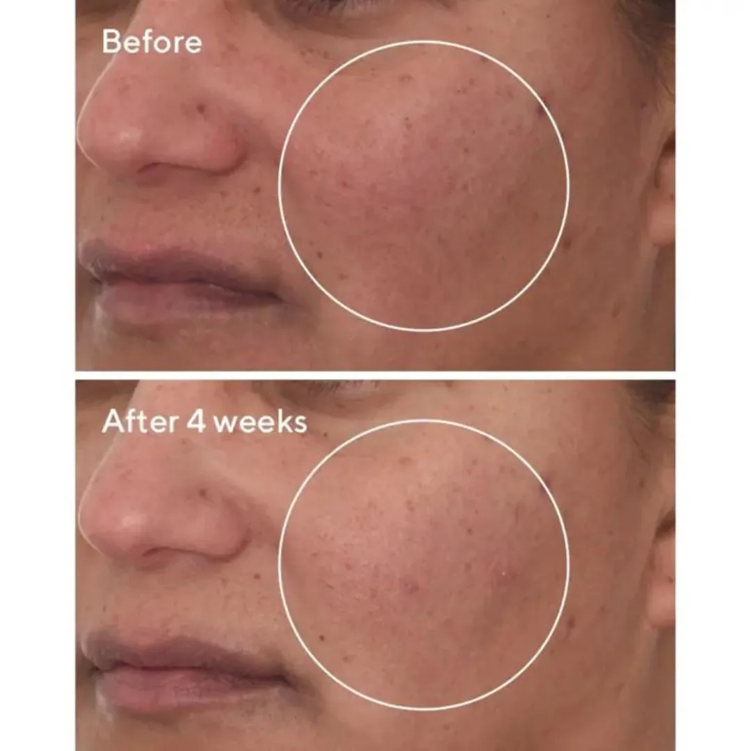 Murad Cellular Hydration Repair Serum
